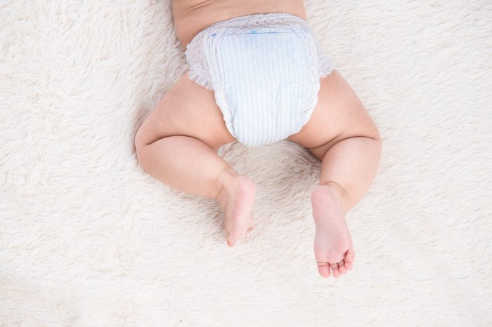 Birthmark on Asian baby girl legs