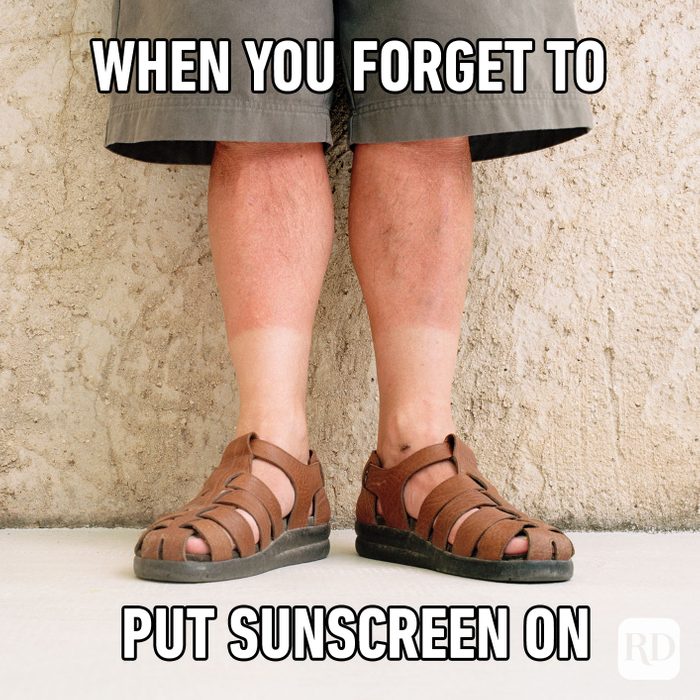 When You Forget To Put Sunscreen On